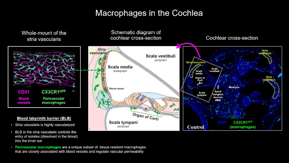 Cathy Sung Macrophages in the Cochlea